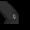 SPORK, NICO - 22.03.1976 - 02.08.2022 - CT obere Extremität - 18:01:46